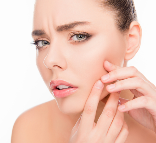 Mulher examinando espinhas no rosto – J&J Consumer Health